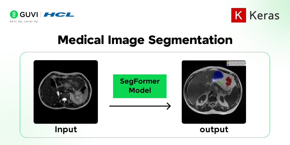 Medical Image Segmentation